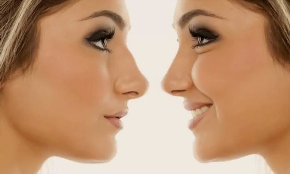 Image default